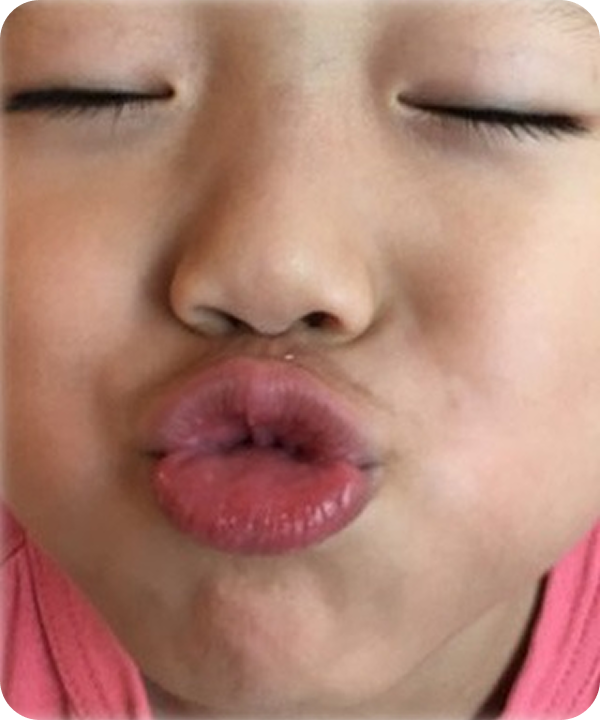 口輪筋トレーニング